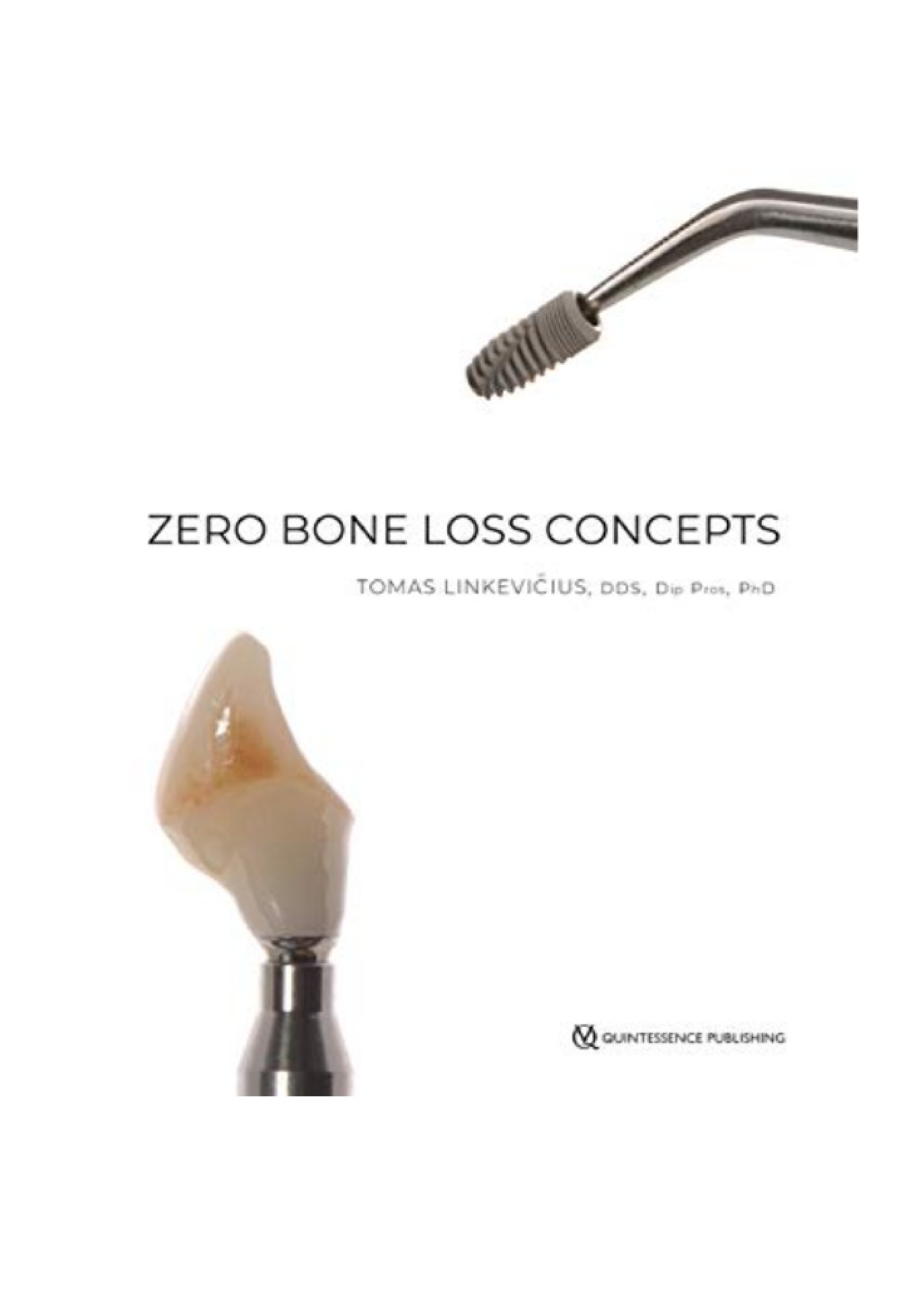 Zero Bone Loss Concepts